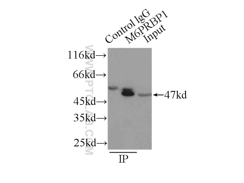 Immunoprecipitation (IP) experiment of HeLa cells using TIP47 Polyclonal antibody (10694-1-AP)