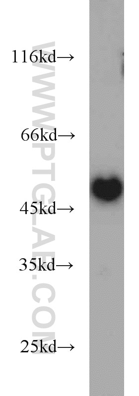 Western Blot (WB) analysis of Jurkat cells using TIP47 Polyclonal antibody (10694-1-AP)