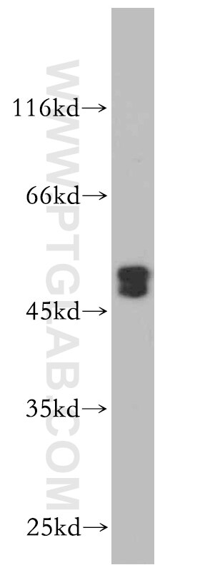 MAB21L2