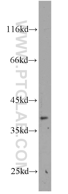 Western Blot (WB) analysis of mouse brain tissue using MAB21L2 Polyclonal antibody (10971-1-AP)