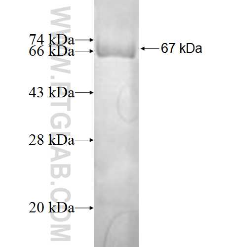 MAB21L2 fusion protein Ag1423 SDS-PAGE