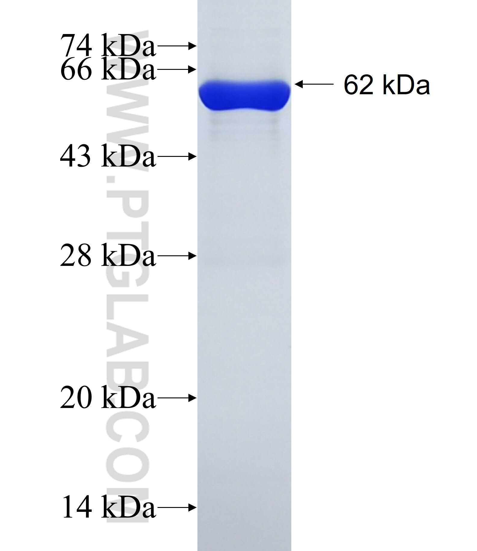 MAB21L2 fusion protein Ag1423 SDS-PAGE