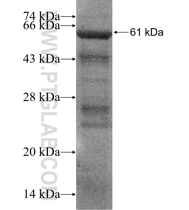 MACC1 fusion protein Ag16884 SDS-PAGE