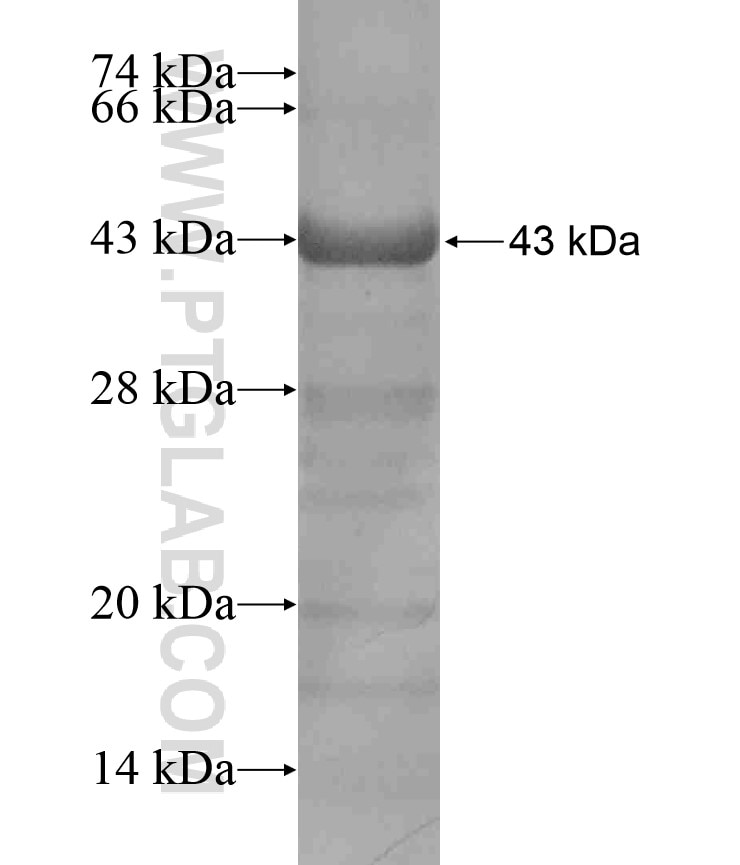 MACC1 fusion protein Ag17445 SDS-PAGE