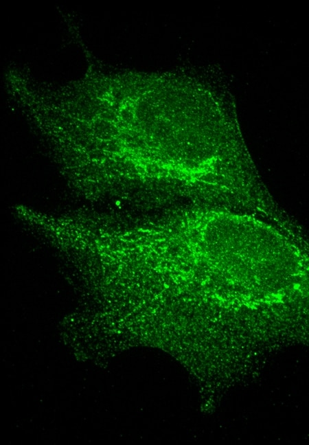 Immunofluorescence (IF) / fluorescent staining of RPE cells using MACF1 Polyclonal antibody (13058-1-AP)