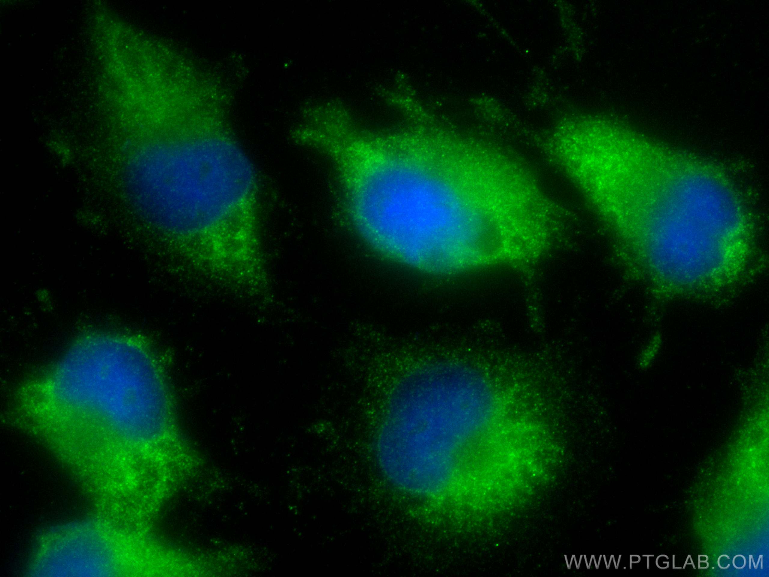 Immunofluorescence (IF) / fluorescent staining of U-251 cells using MACF1 Polyclonal antibody (13058-1-AP)