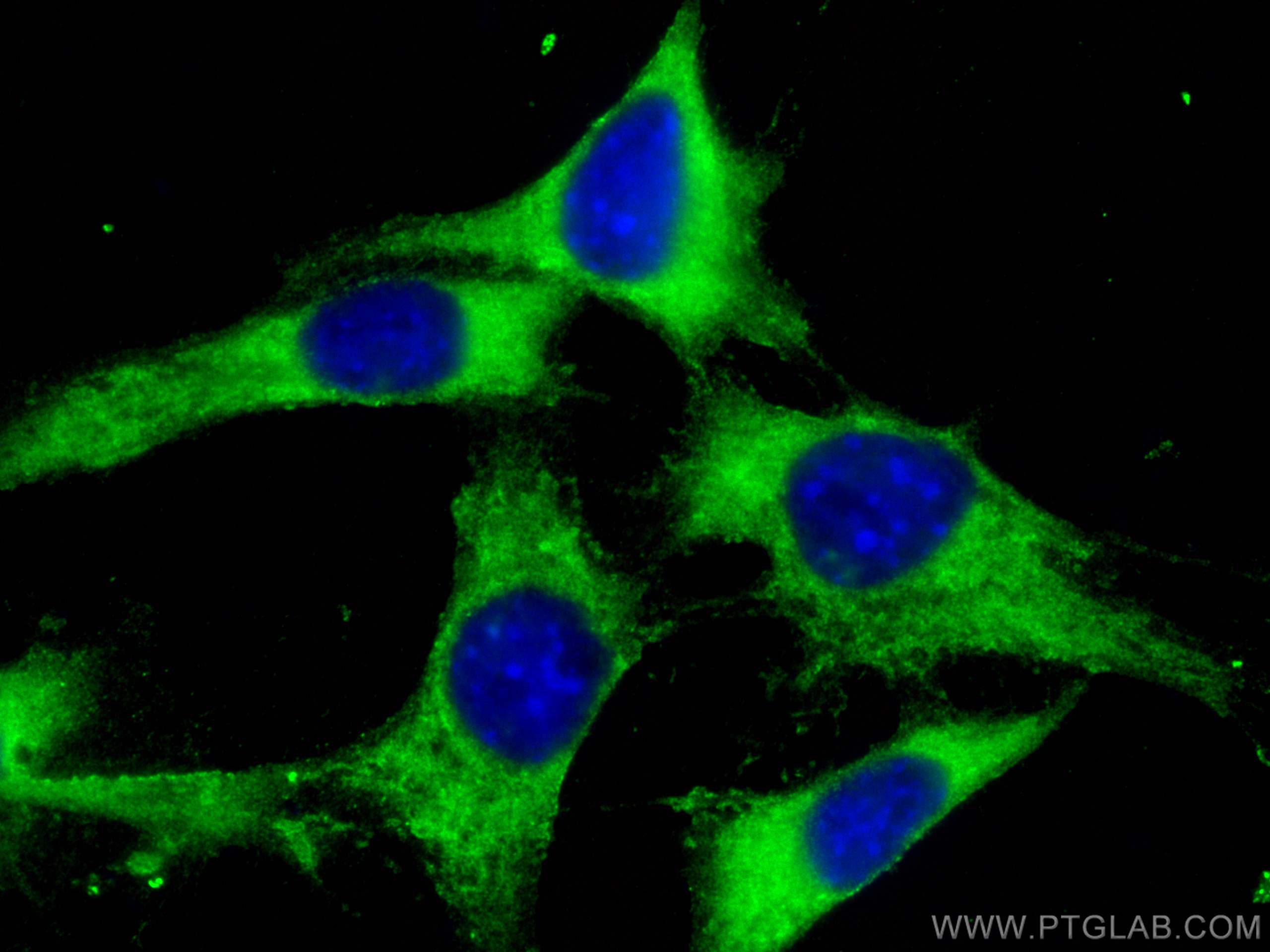 Immunofluorescence (IF) / fluorescent staining of NIH/3T3 cells using MACF1 Polyclonal antibody (13058-1-AP)