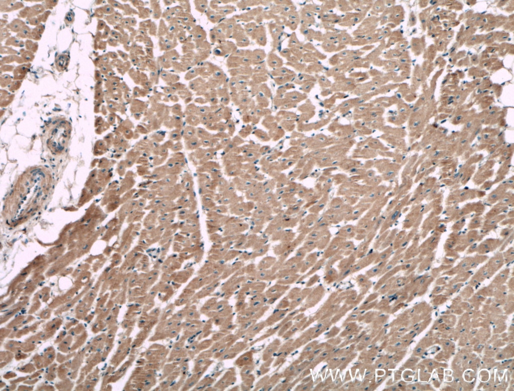 Immunohistochemistry (IHC) staining of human heart tissue using MACF1 Polyclonal antibody (13058-1-AP)