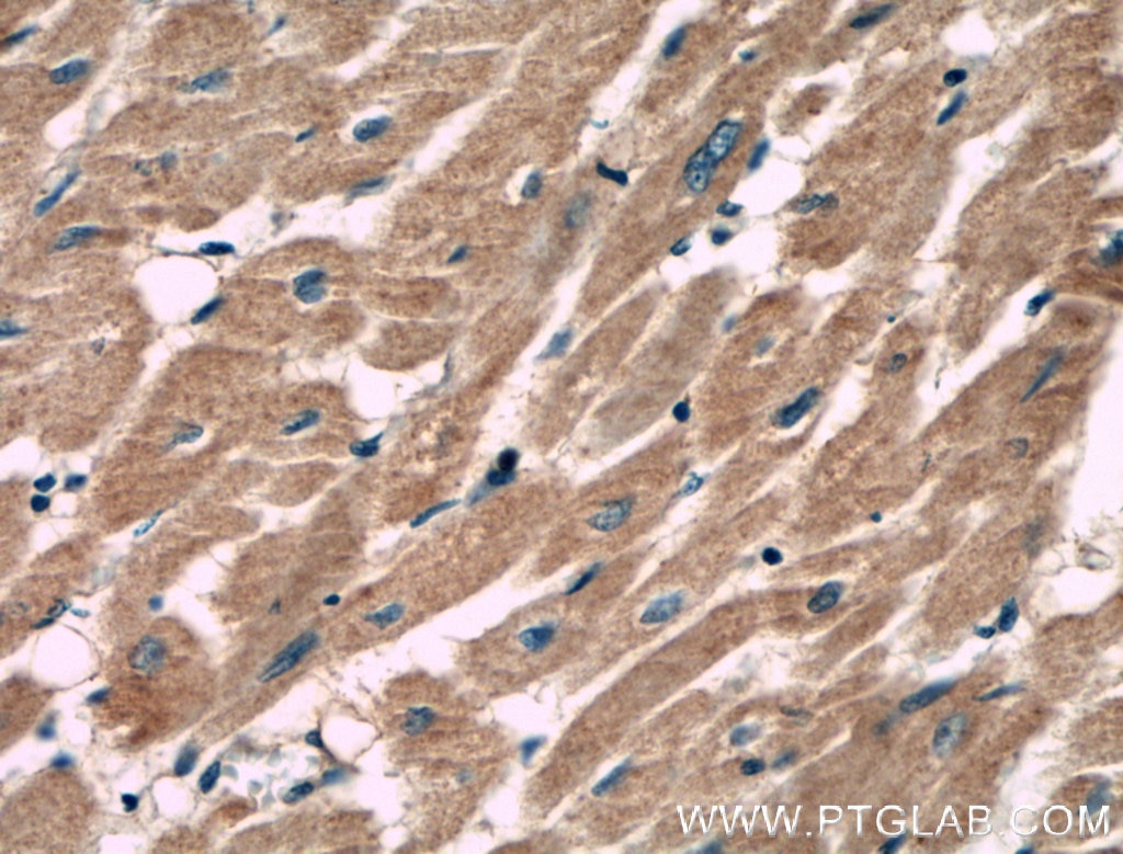 Immunohistochemistry (IHC) staining of human heart tissue using MACF1 Polyclonal antibody (13058-1-AP)