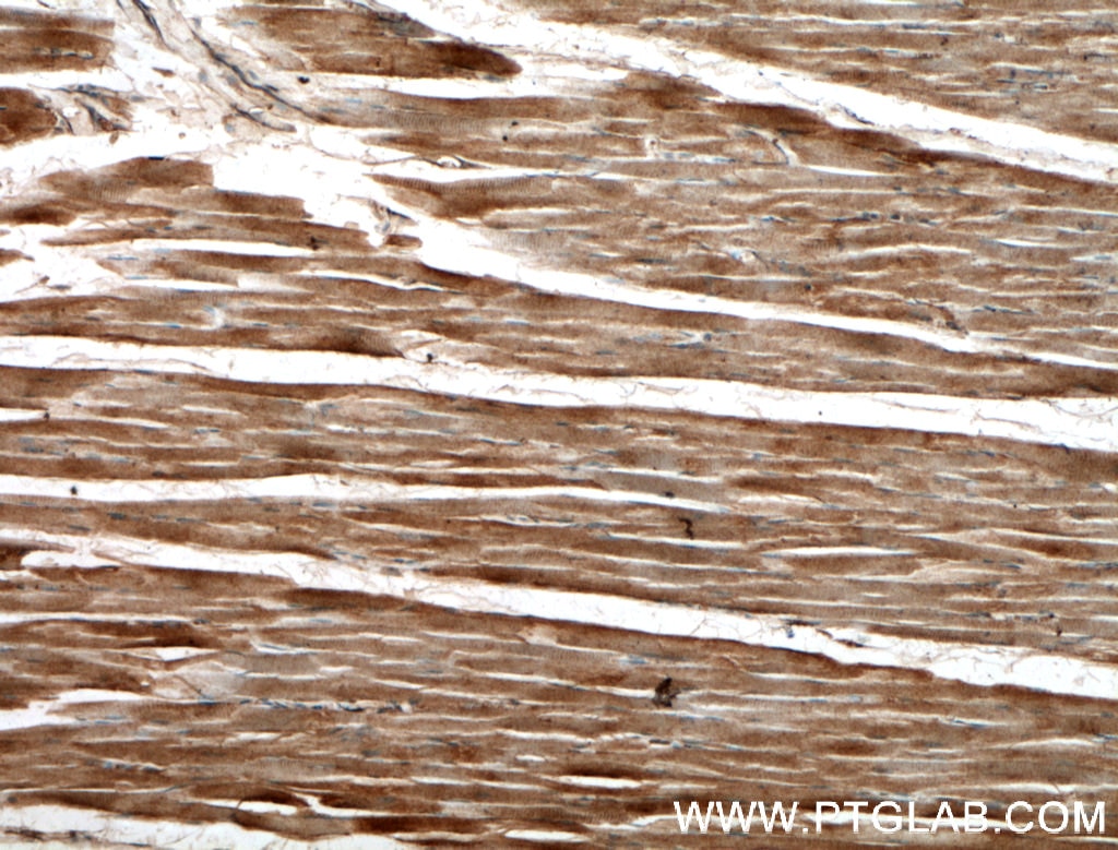 IHC staining of human skeletal muscle using 13058-1-AP