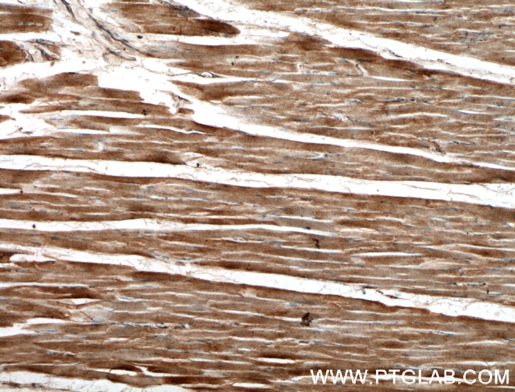 Immunohistochemistry (IHC) staining of human skeletal muscle tissue using MACF1 Polyclonal antibody (13058-1-AP)