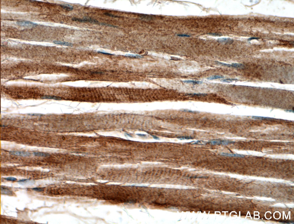 IHC staining of human skeletal muscle using 13058-1-AP