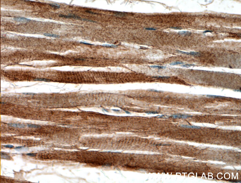 Immunohistochemistry (IHC) staining of human skeletal muscle tissue using MACF1 Polyclonal antibody (13058-1-AP)