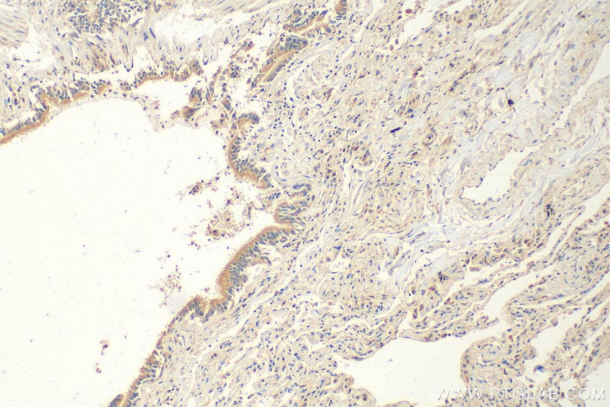 Immunohistochemistry (IHC) staining of human lung tissue using MACF1 Polyclonal antibody (13058-1-AP)