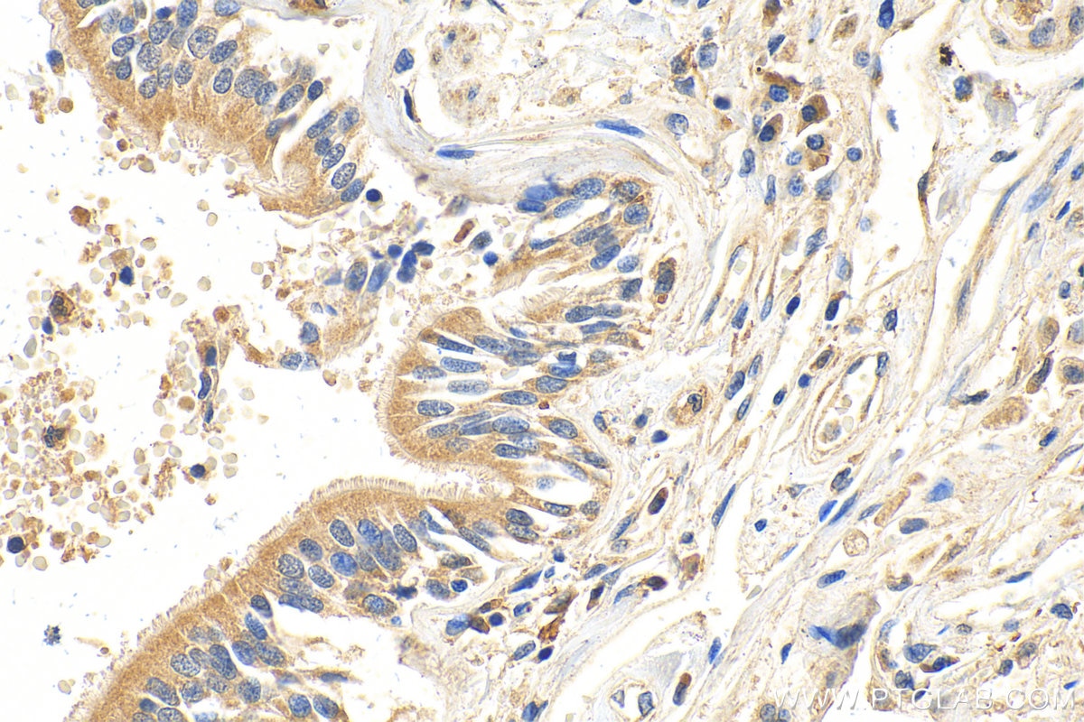 Immunohistochemistry (IHC) staining of human lung tissue using MACF1 Polyclonal antibody (13058-1-AP)