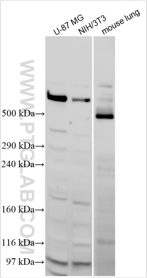 Western Blot (WB) analysis of various lysates using MACF1 Polyclonal antibody (13058-1-AP)