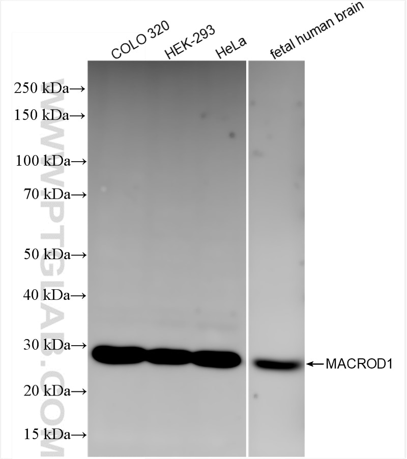 Western Blot (WB) analysis of various lysates using MACROD1 Recombinant antibody (84398-3-RR)
