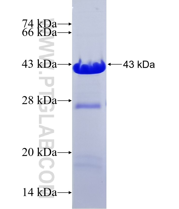 MACROD2 fusion protein Ag37368 SDS-PAGE MACROD2 fusion protein Ag37368 SDS-PAGE