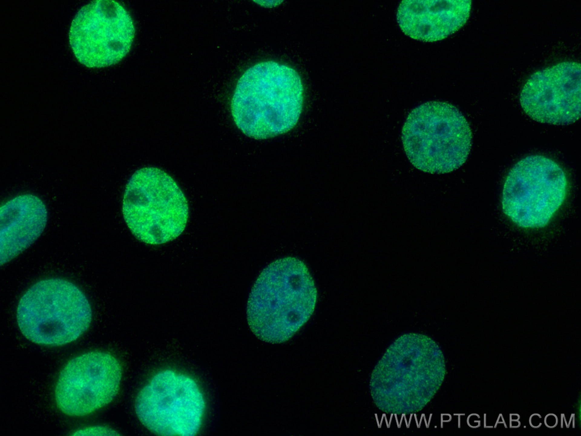 Immunofluorescence (IF) / fluorescent staining of A431 cells using MAD1 Polyclonal antibody (18322-1-AP)