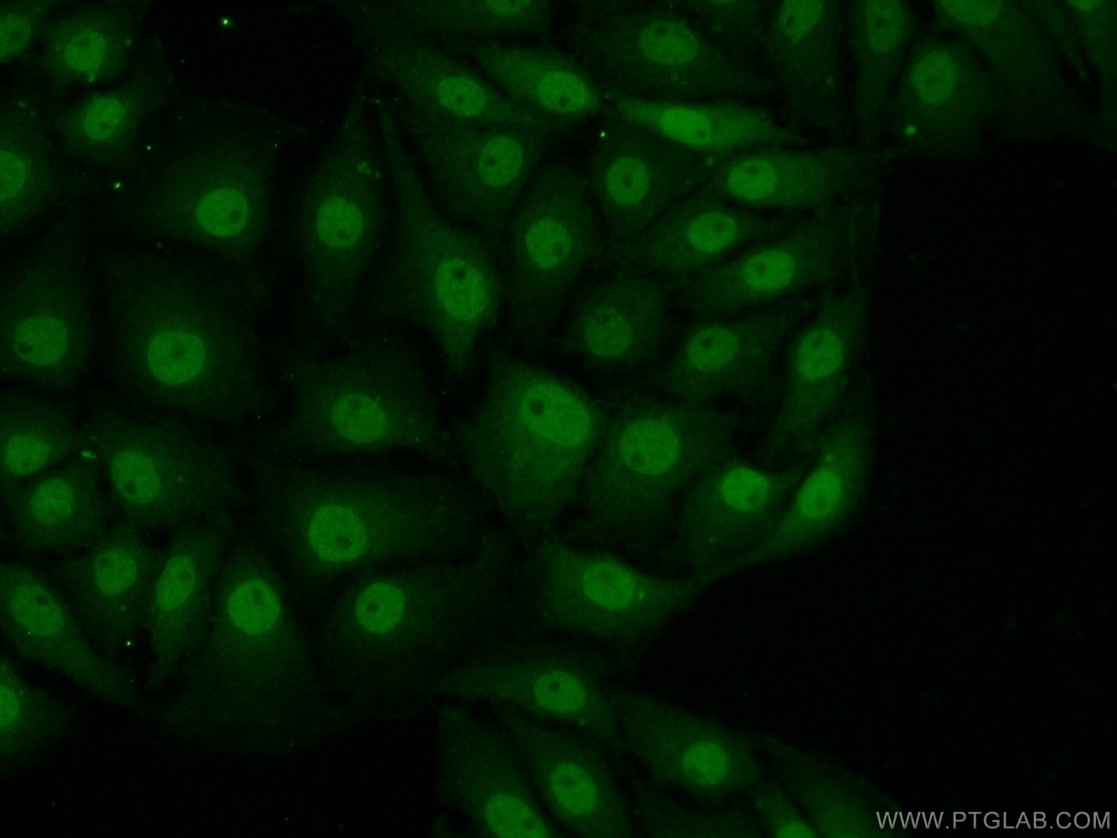 Immunofluorescence (IF) / fluorescent staining of SH-SY5Y cells using MAD1 Polyclonal antibody (18322-1-AP)