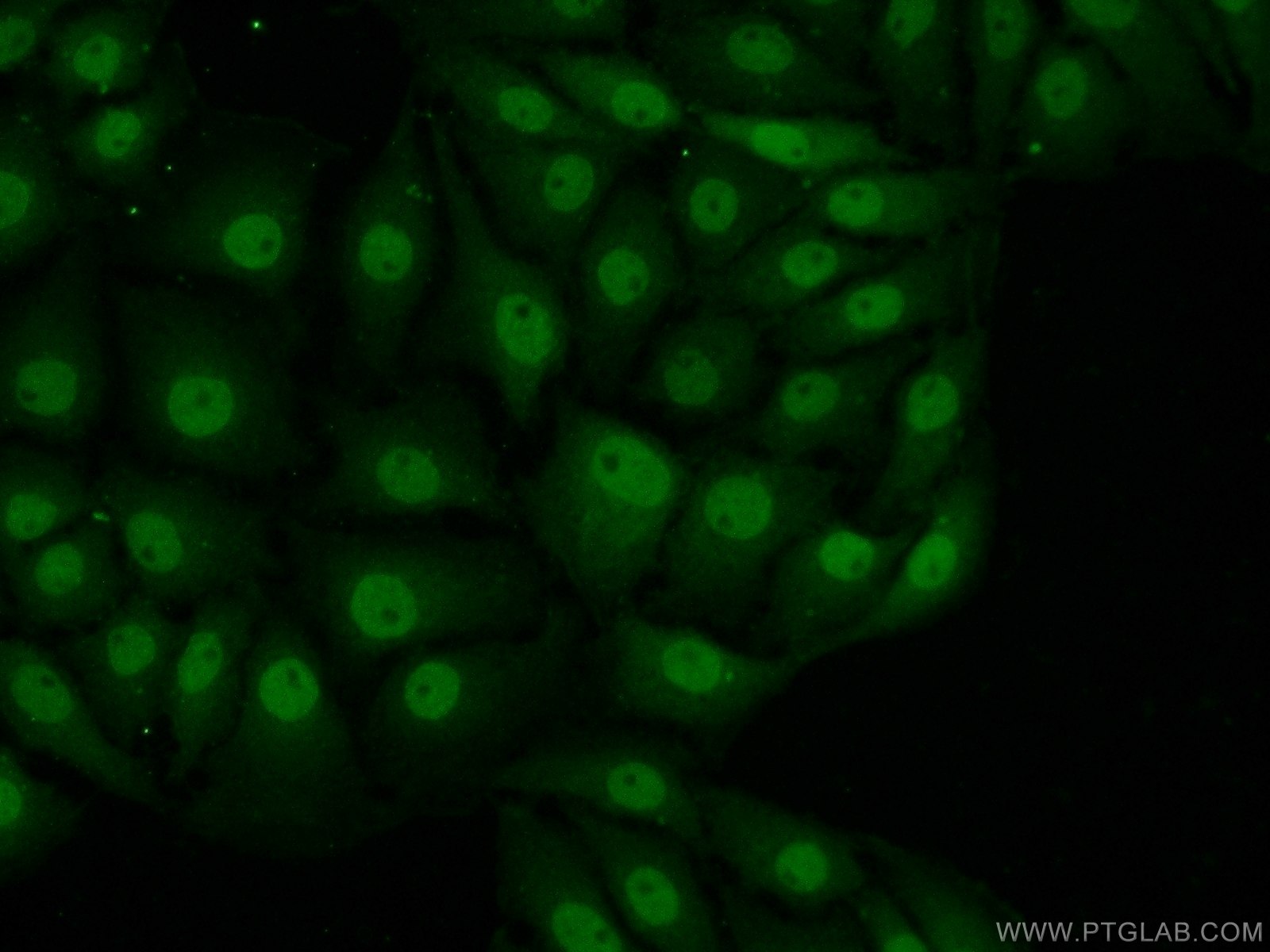 IF Staining of SH-SY5Y using 18322-1-AP