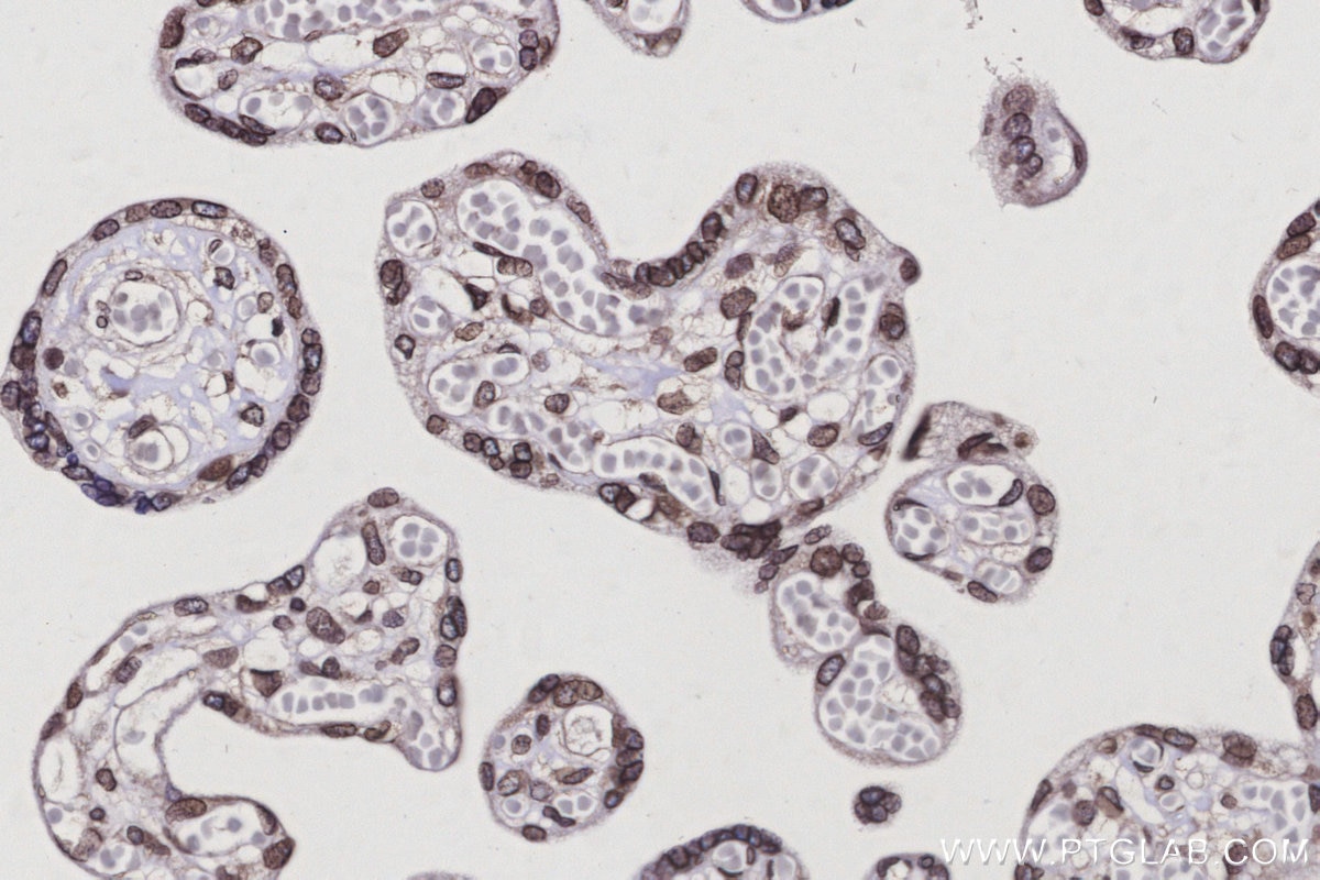 Immunohistochemistry (IHC) staining of human placenta tissue using MAD1 Polyclonal antibody (18322-1-AP)
