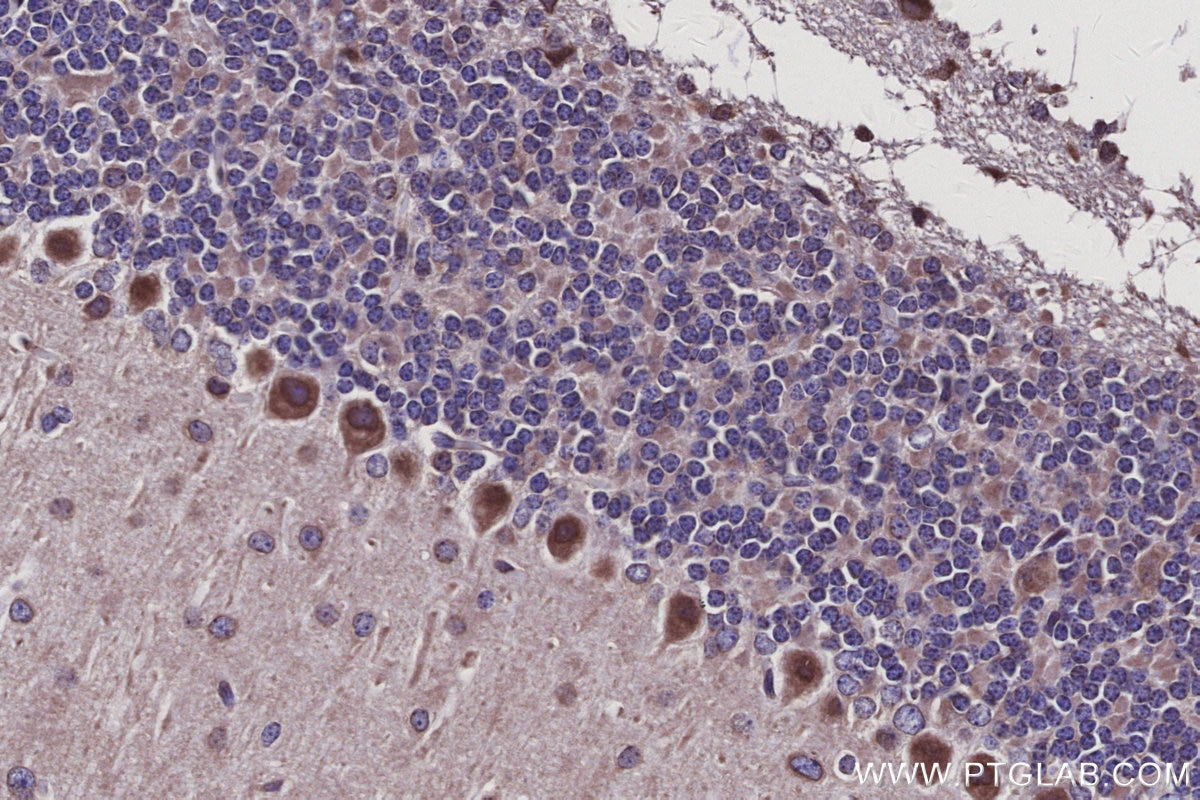 Immunohistochemistry (IHC) staining of mouse cerebellum tissue using MAD1 Polyclonal antibody (18322-1-AP)