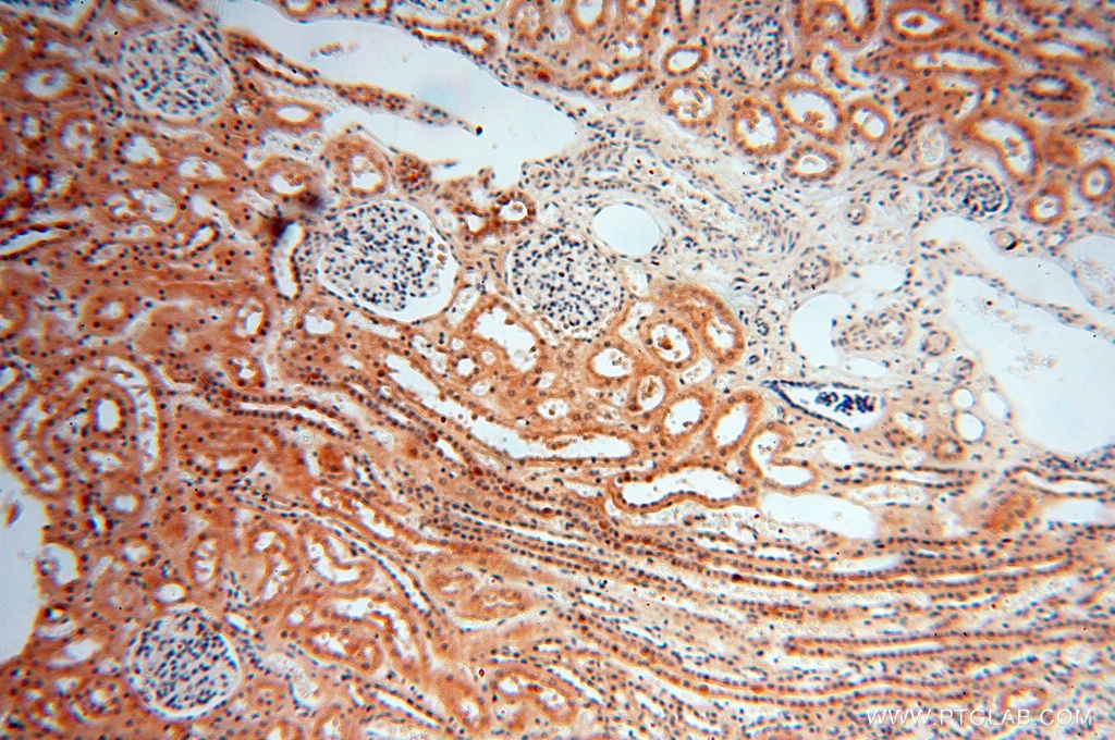 Immunohistochemistry (IHC) staining of human kidney tissue using MAD1 Polyclonal antibody (18322-1-AP)
