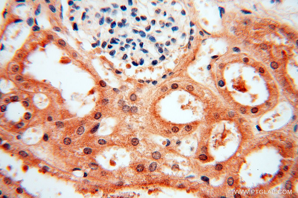 Immunohistochemistry (IHC) staining of human kidney tissue using MAD1 Polyclonal antibody (18322-1-AP)