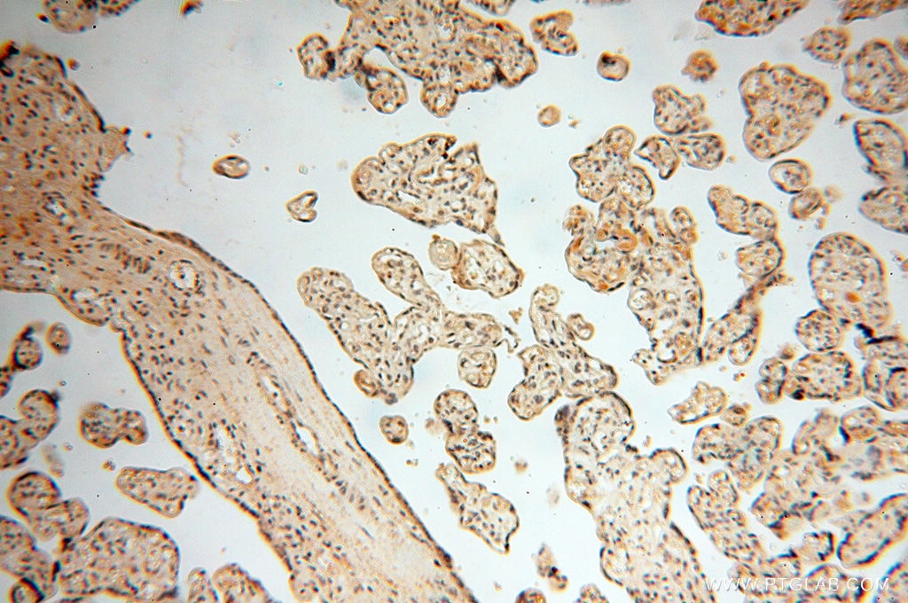 Immunohistochemistry (IHC) staining of human placenta tissue using MAD1 Polyclonal antibody (18322-1-AP)