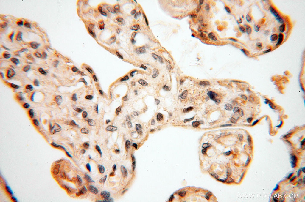 Immunohistochemistry (IHC) staining of human placenta tissue using MAD1 Polyclonal antibody (18322-1-AP)