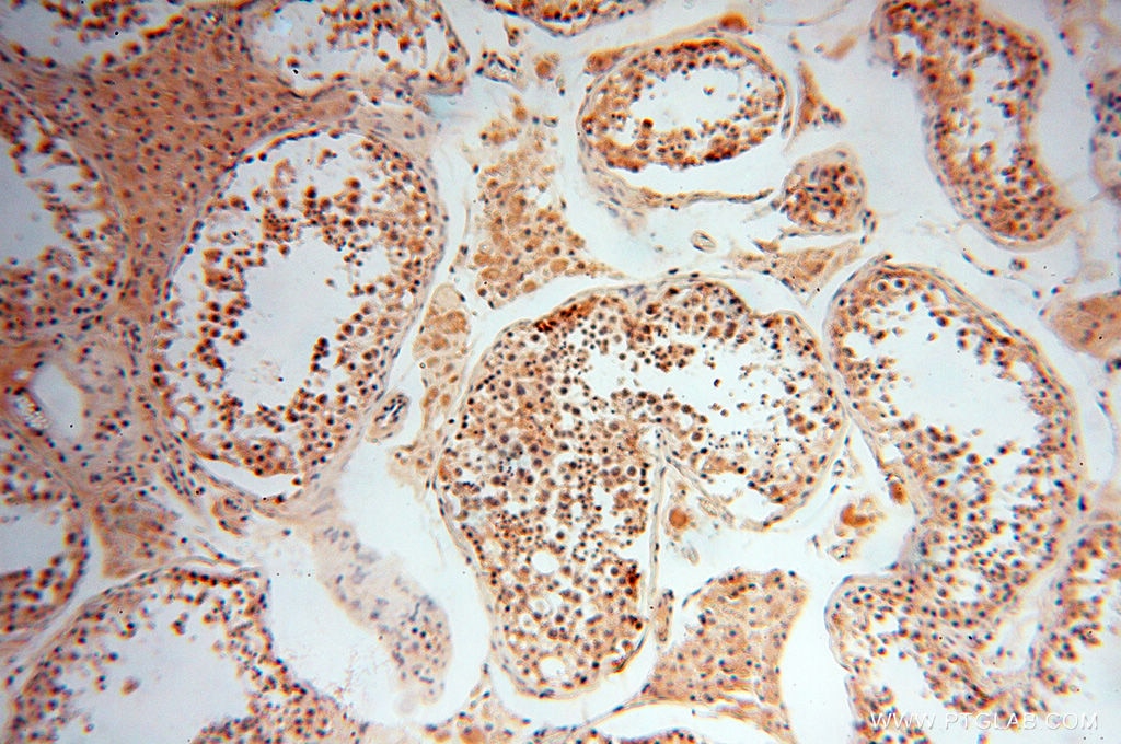Immunohistochemistry (IHC) staining of human testis tissue using MAD1 Polyclonal antibody (18322-1-AP)