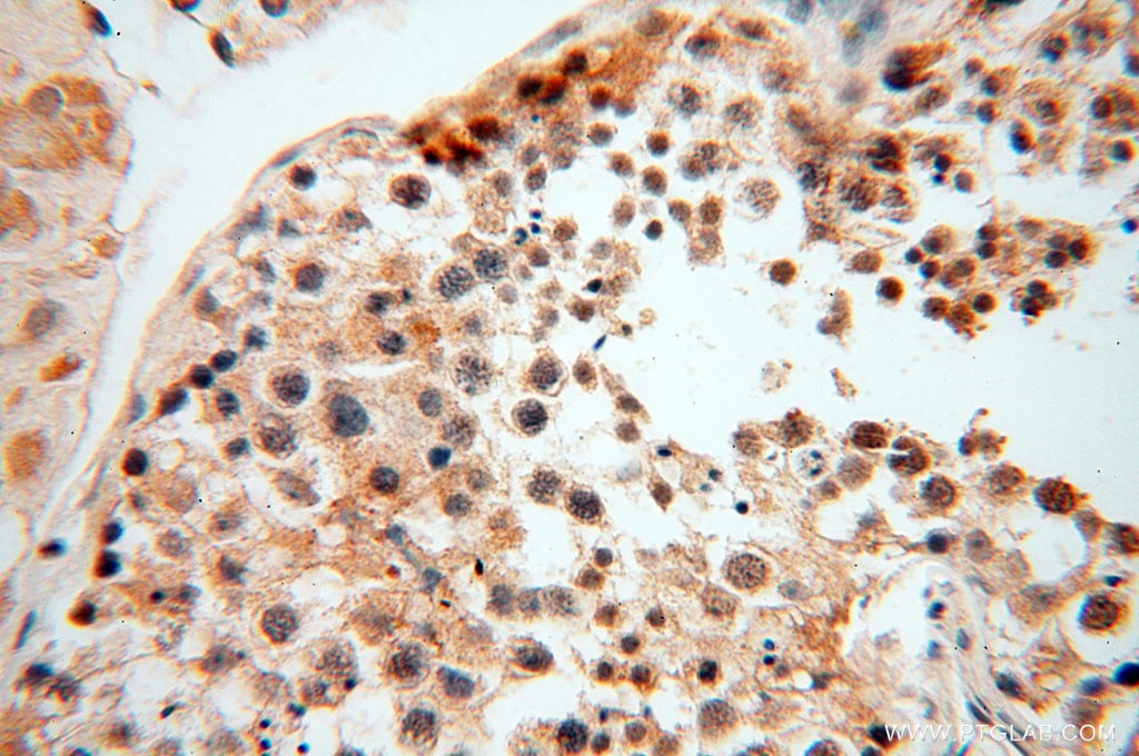 Immunohistochemistry (IHC) staining of human testis tissue using MAD1 Polyclonal antibody (18322-1-AP)