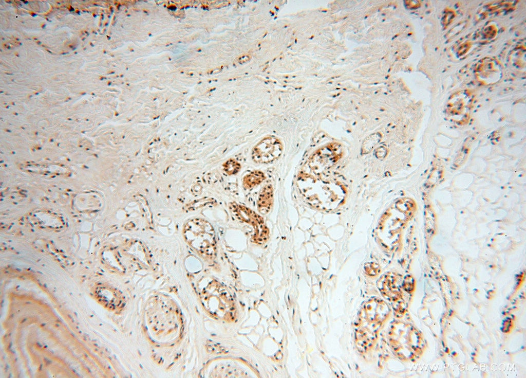 Immunohistochemistry (IHC) staining of human skin tissue using MAD1 Polyclonal antibody (18322-1-AP)