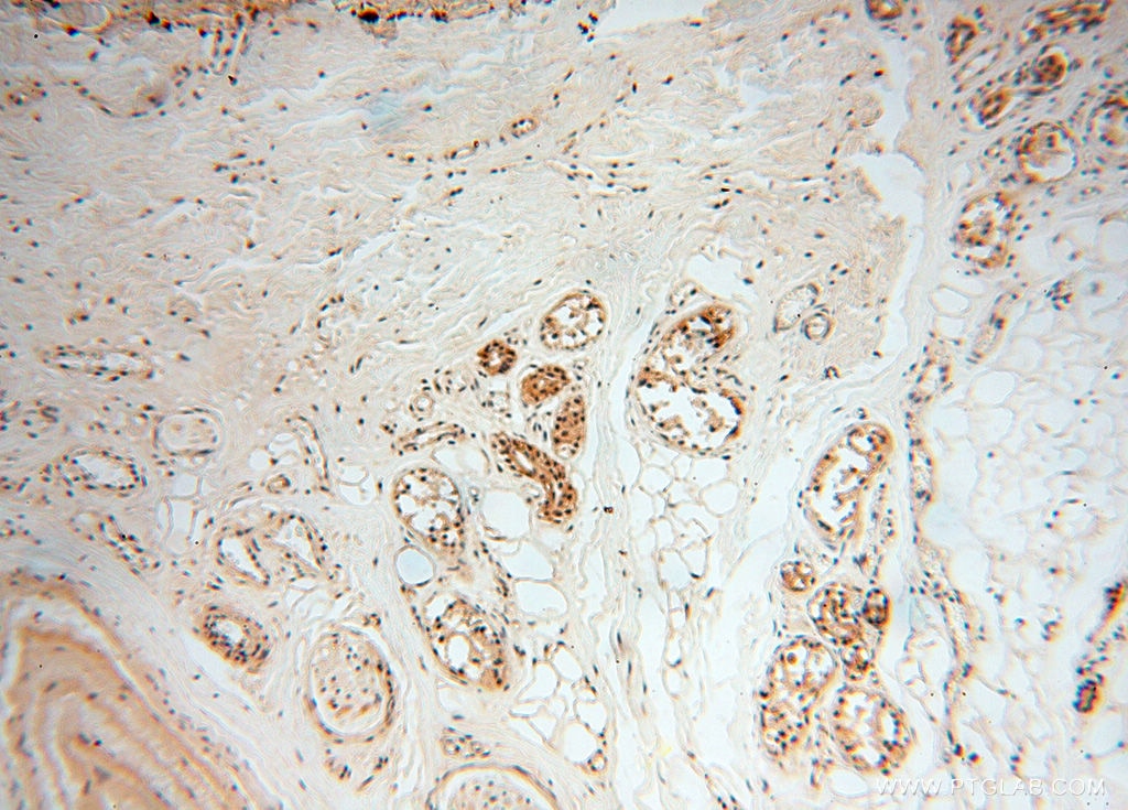 IHC staining of human skin using 18322-1-AP