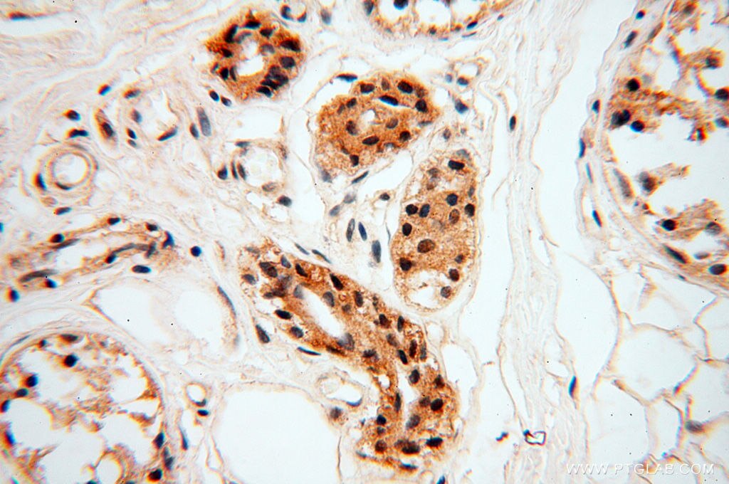 Immunohistochemistry (IHC) staining of human skin tissue using MAD1 Polyclonal antibody (18322-1-AP)