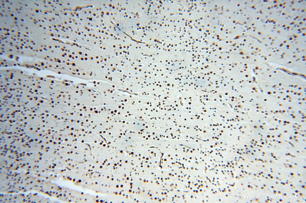 Immunohistochemistry (IHC) staining of human brain tissue using MAD1 Polyclonal antibody (18322-1-AP)