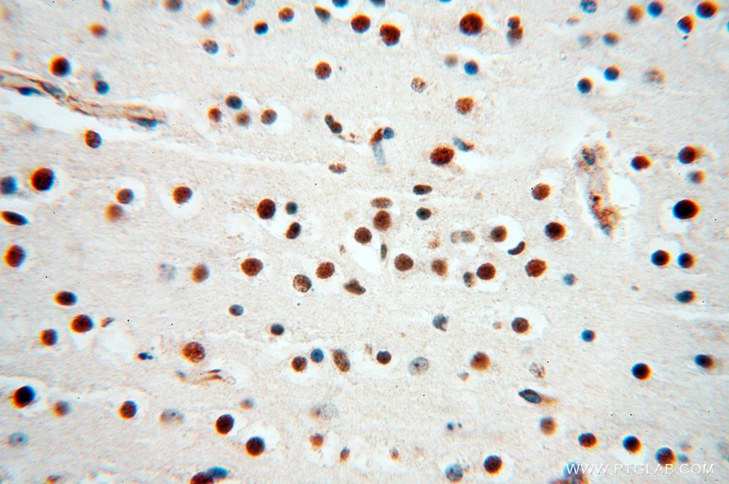 Immunohistochemistry (IHC) staining of human brain tissue using MAD1 Polyclonal antibody (18322-1-AP)