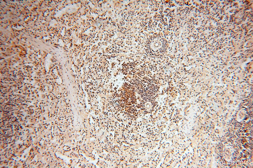 Immunohistochemistry (IHC) staining of human spleen tissue using MAD1 Polyclonal antibody (18322-1-AP)