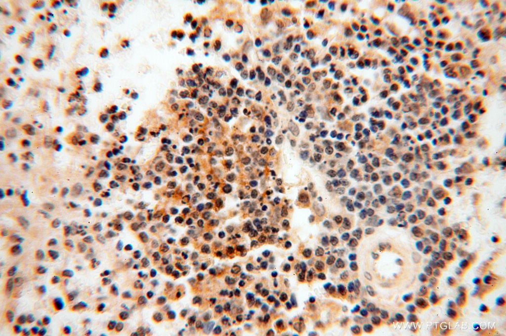 Immunohistochemistry (IHC) staining of human spleen tissue using MAD1 Polyclonal antibody (18322-1-AP)