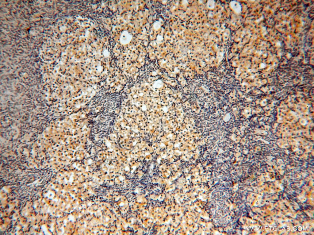 Immunohistochemistry (IHC) staining of human ovary tissue using MAD1 Polyclonal antibody (18322-1-AP)