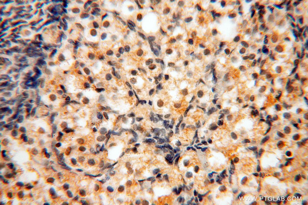 Immunohistochemistry (IHC) staining of human ovary tissue using MAD1 Polyclonal antibody (18322-1-AP)