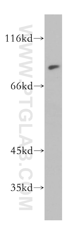 Western Blot (WB) analysis of human brain tissue using MAD1 Polyclonal antibody (18322-1-AP)