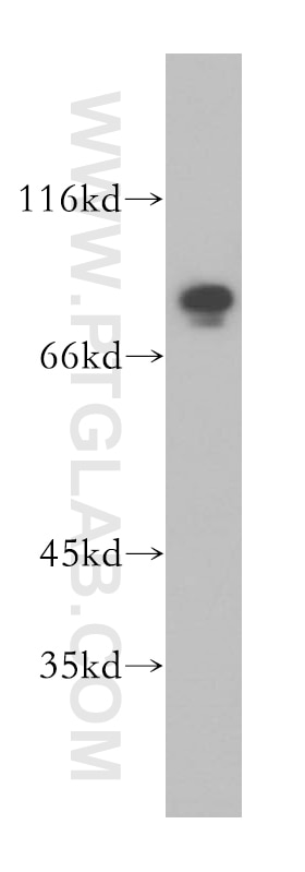 MAD1 Polyclonal antibody