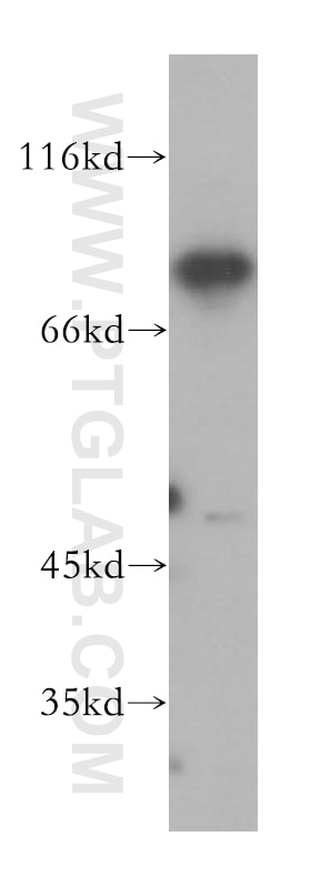 Western Blot (WB) analysis of Raji cells using MAD1 Polyclonal antibody (18322-1-AP)