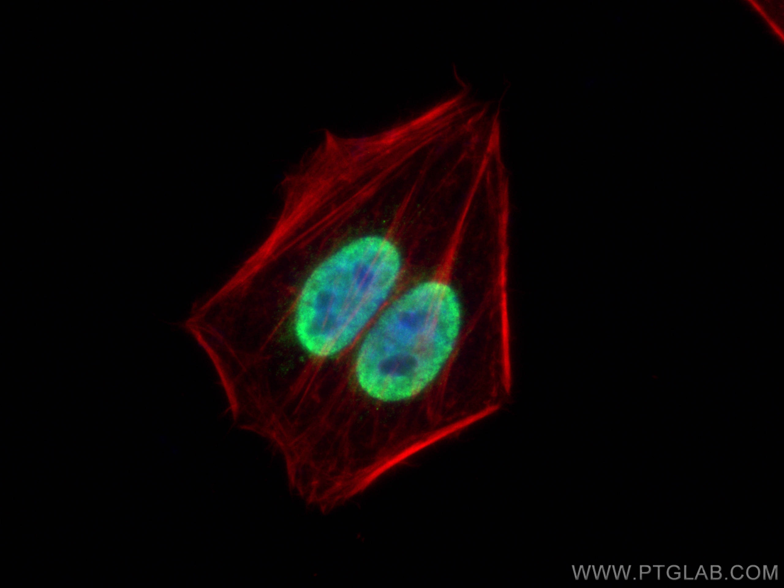Immunofluorescence (IF) / fluorescent staining of HepG2 cells using MAD2L1 Polyclonal antibody (10337-1-AP)