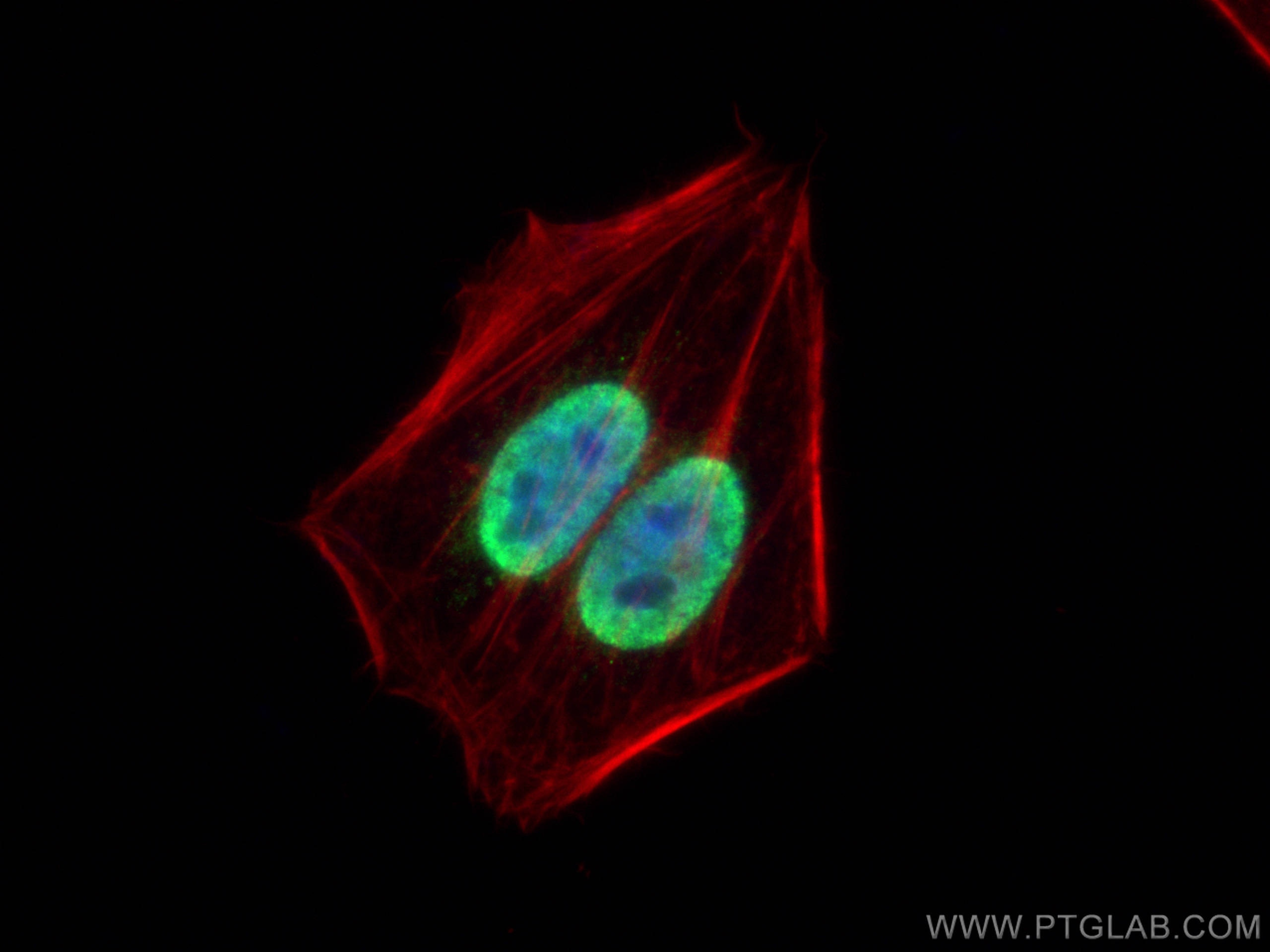 IF Staining of HepG2 using 10337-1-AP