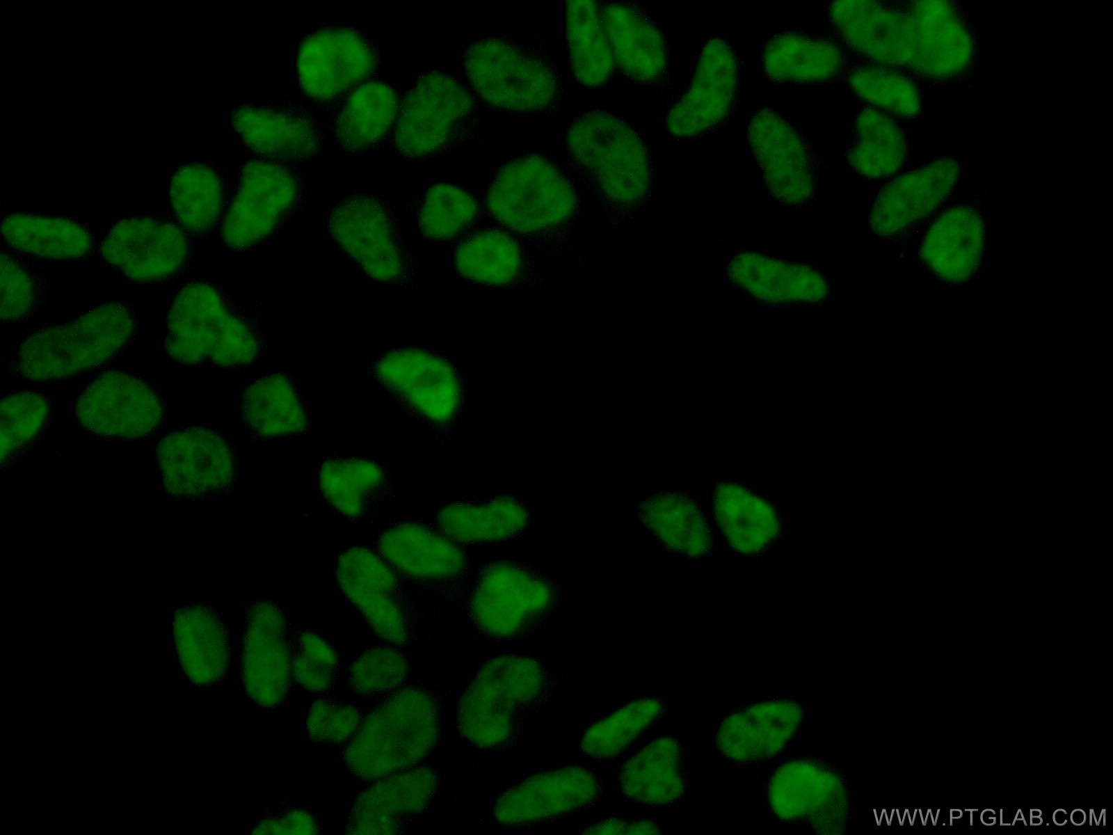 Immunofluorescence (IF) / fluorescent staining of HEK-293 cells using MAD2L1 Polyclonal antibody (10337-1-AP)