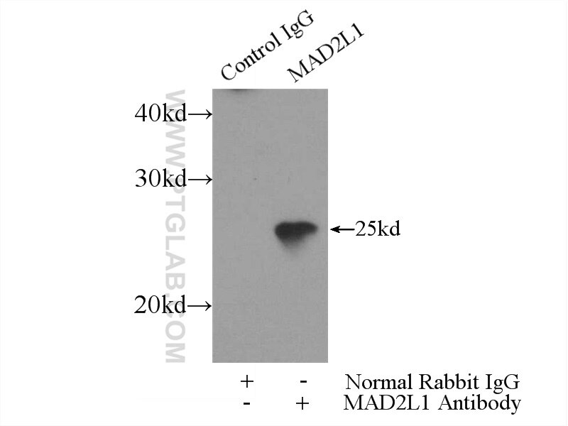 IP experiment of HEK-293 using 10337-1-AP