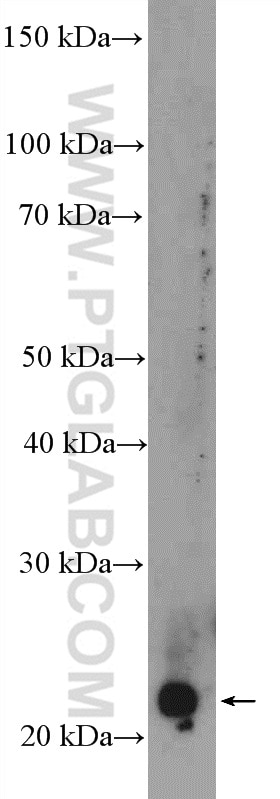 Western Blot (WB) analysis of rat liver tissue using MAD2L1 Polyclonal antibody (10337-1-AP)